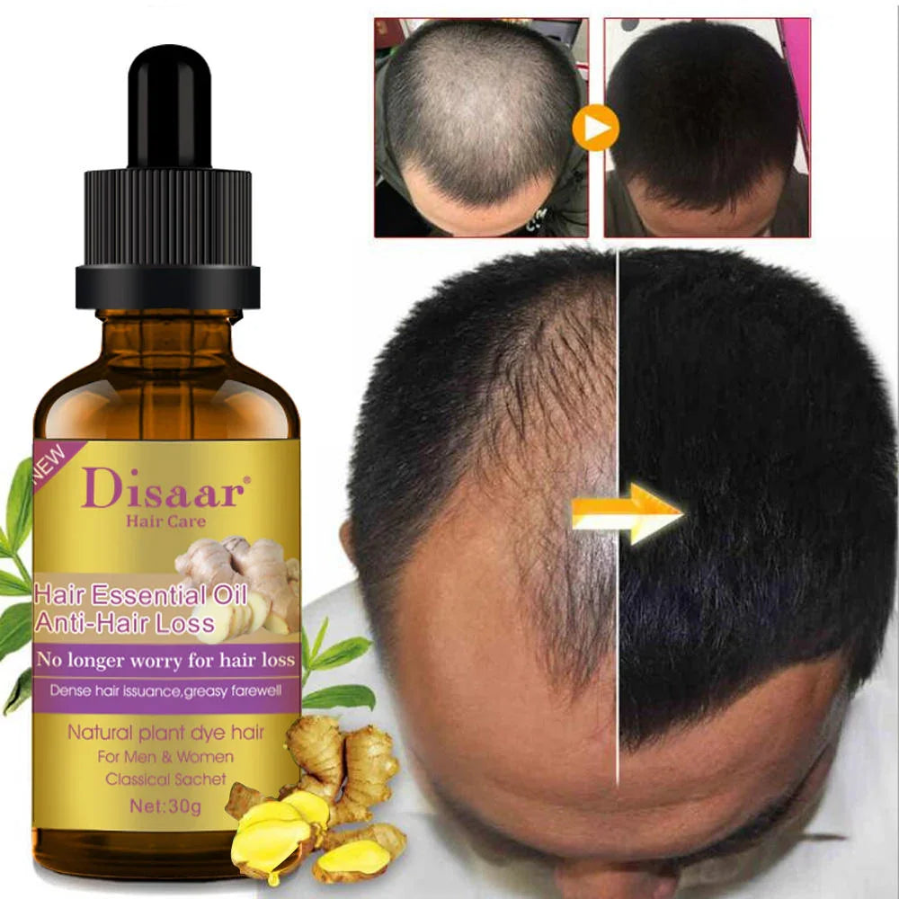 زيت ديزار العطري للشعر المضاد لتساقط الشعر 30 جم