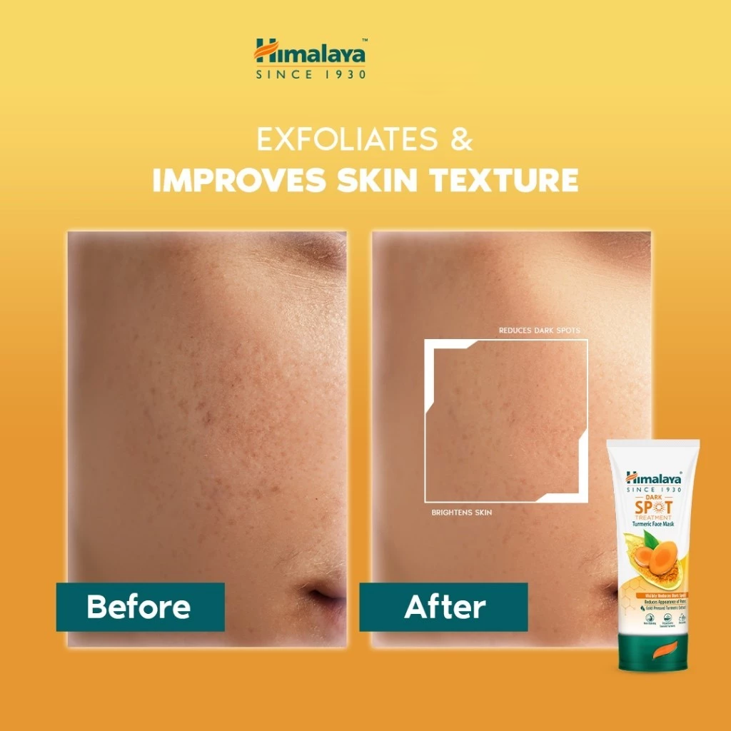Himalaya Dark Spot Clearing Turmeric Face Mask - 100ml