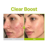 Purito Azelaic Acid 10 Kojic Tea Tree Facial Serum - 30ml