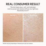 Arencia Fresh Rosehip Rice Mochi Cleanser - 120g