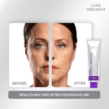 Luxe Organix Retinol + Bakuchiol Overnight Glow Gentle Treatment Cream - 30g