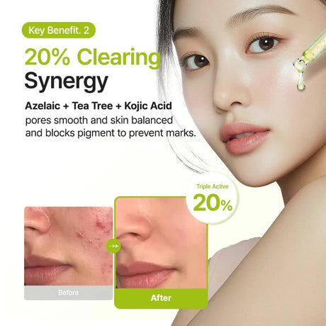 Purito Azelaic Acid 10 Kojic Tea Tree Facial Serum - 30ml