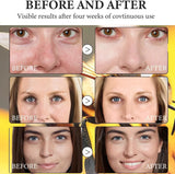 Hoygi Botoxin Bee Venom Firming Serum Stick - 30g