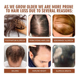 Eelhoe Batana Oil For Revitalized Hair Growth & Strength - 120ml