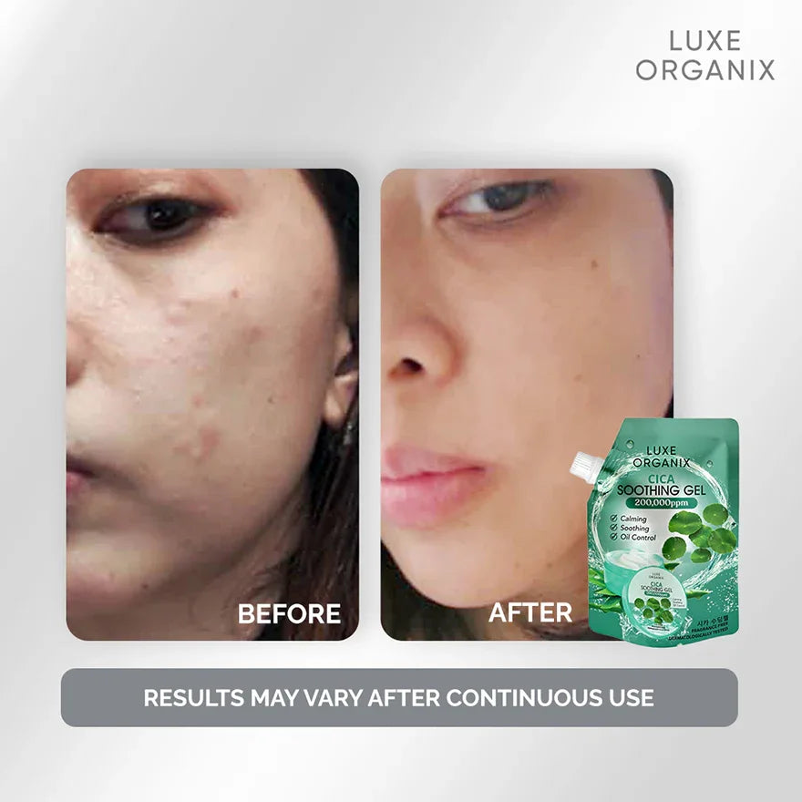 Luxe Organix Cica Soothing Gel - 100ml