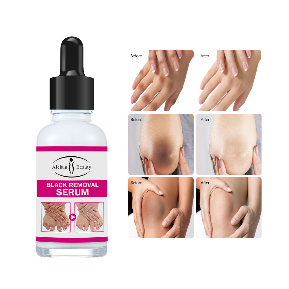 Aichun Beauty Elbow & Knee Brightening Serum - 30ml