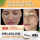 2NE2 MelaGlow Melasma Soap - 100g