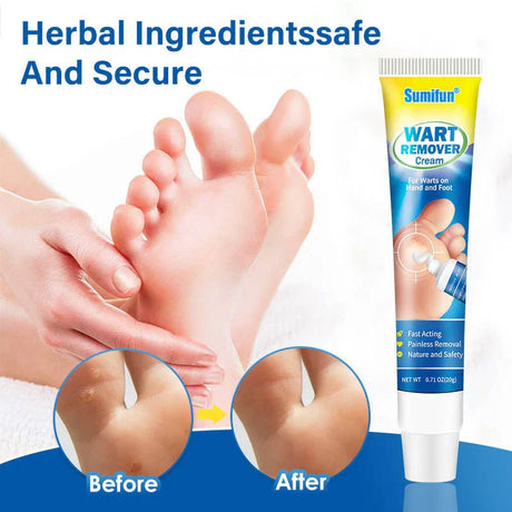 Sumifun Wart Remover Cream - 20g