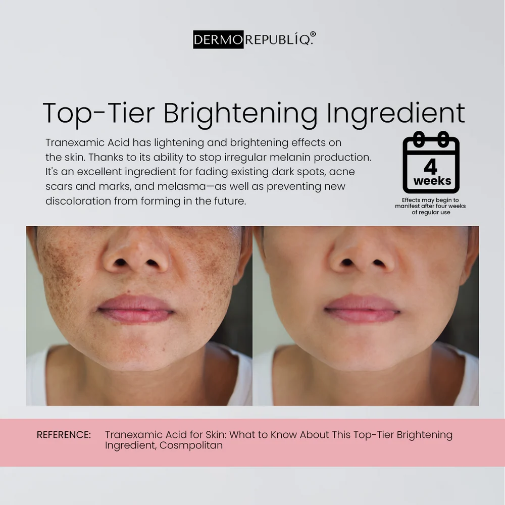 Dermorepubliq 10% Niacinamide Ultra White Formula Serum - 30ml
