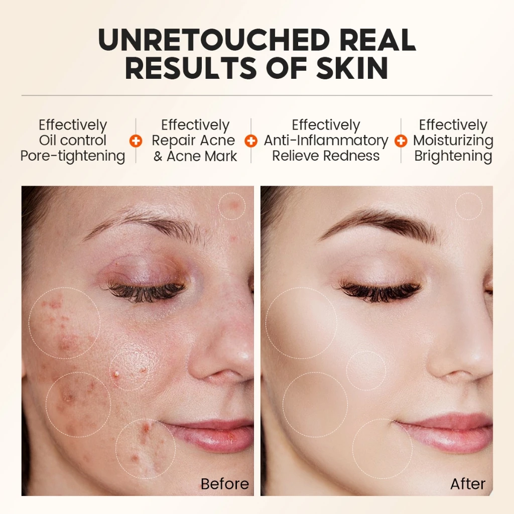 Vibrant Glamour Salicylic Acid 1% Exfoliating Mask - 60g