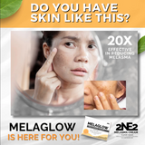 2NE2 MelaGlow Melasma Soap - 100g