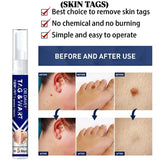 Dr. Davey Maximum Strength Tag & Wart Remover - 16ml