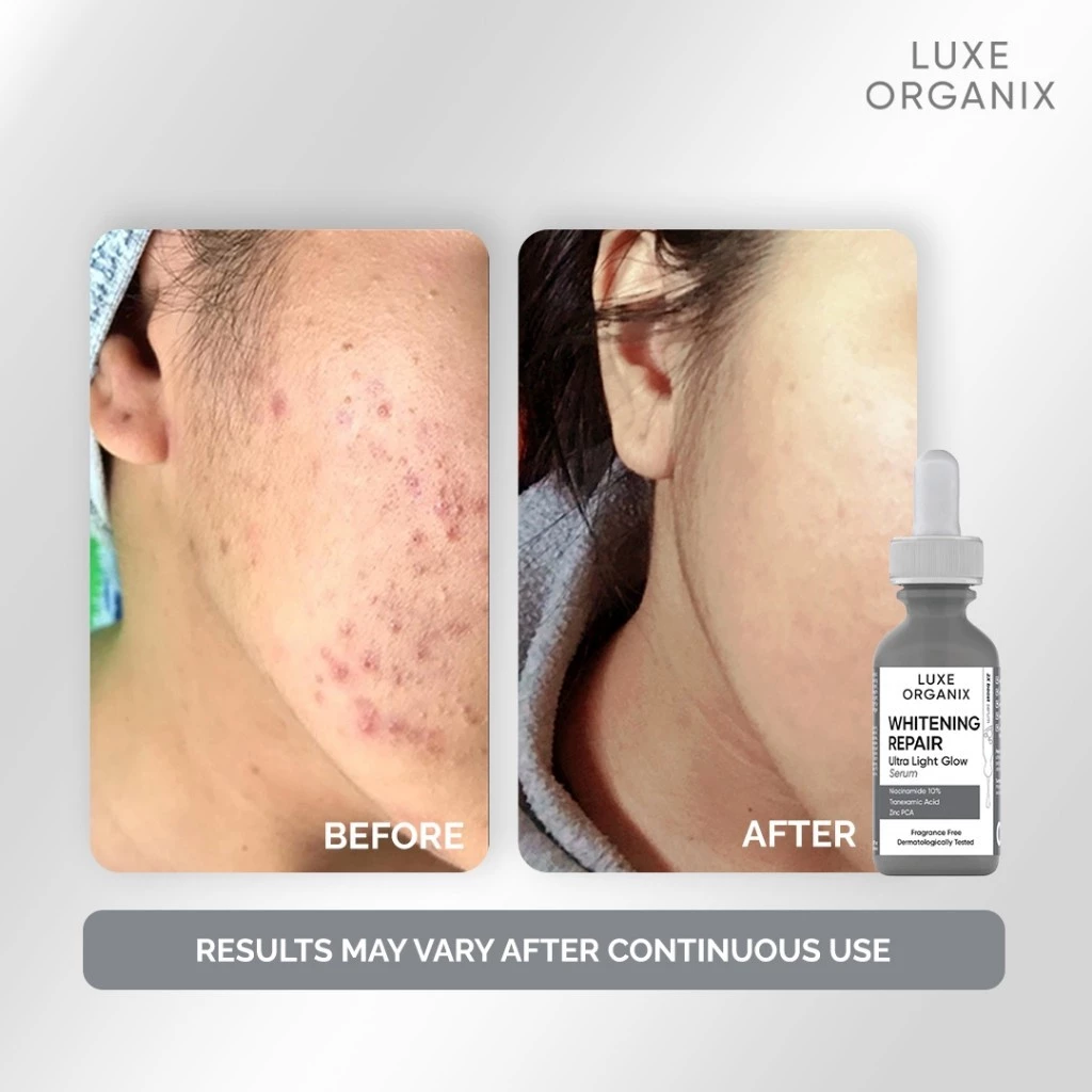 Luxe Organix Brightening Repair Ultra Light Glow Serum - 30ml