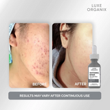 Luxe Organix Brightening Repair Ultra Light Glow Serum - 30ml