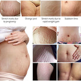 Vibrant Glamour Stretch Marks Remover Cream - 30g