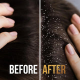 Pantene Pro-V Anti-Dandruff 2 in 1 Shampoo + Conditioner - 200ml