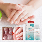 EELHOE Fungal Nail Treatment - 10ml