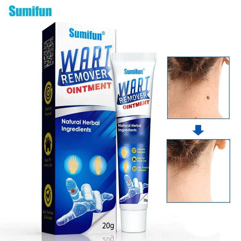 Sumifun Wart Remover Ointment - 20g