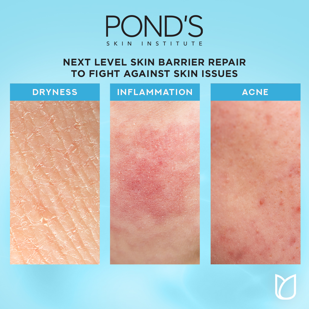 Pond's Hydra Miracle Ultra Light Biome Moisturizer Gel - 50g