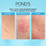 Pond's Hydra Miracle Ultra Light Biome Moisturizer Gel - 50g