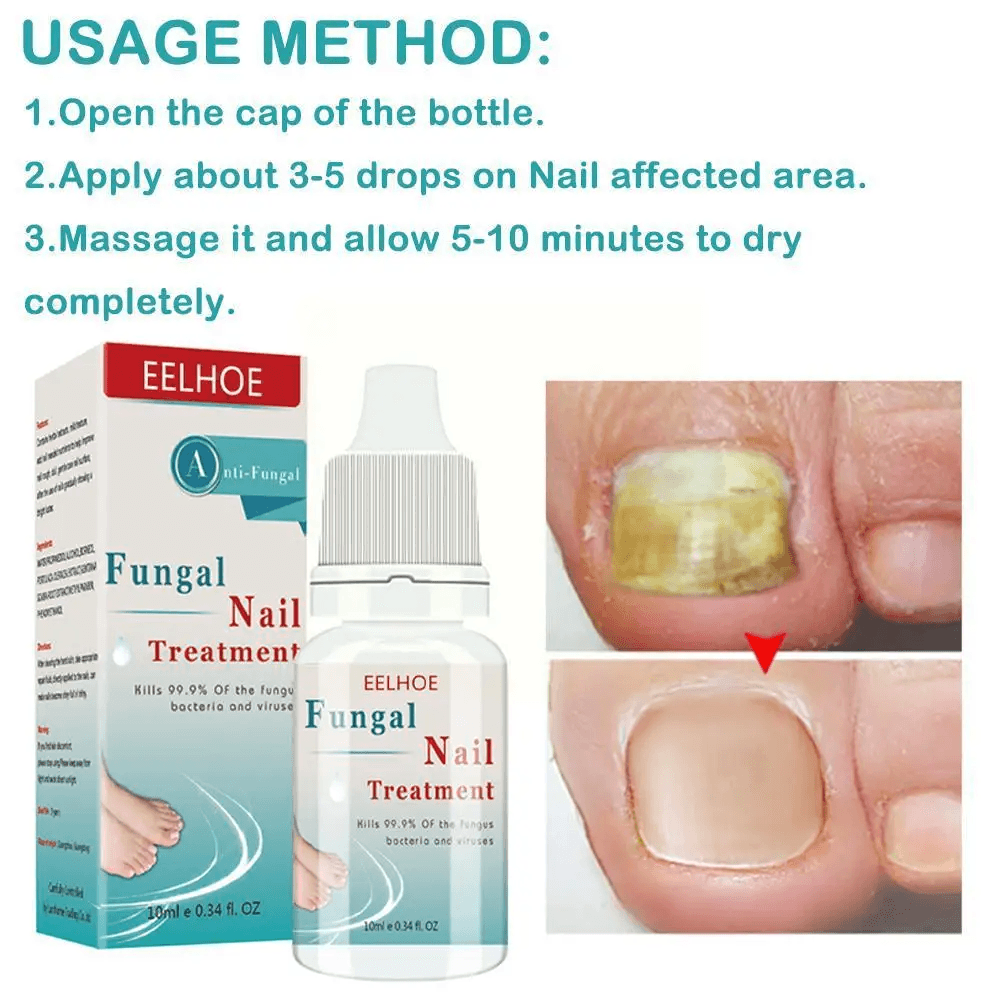 EELHOE Fungal Nail Treatment - 10ml