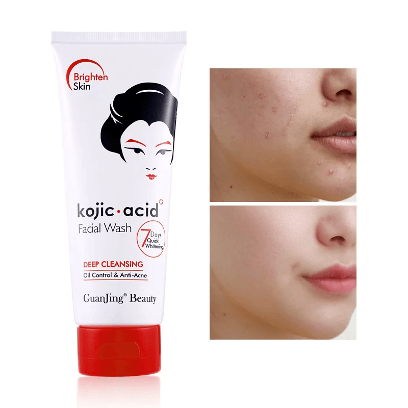 Guanjing Beauty Deep Cleansing Anti-Acne Facial Wash - 100g