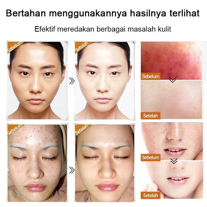 Kiss Beauty Kojic Acid Brighter Moisture Face Cream - 50g