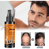 Jaysuing Hair & Beard Growth Spray - 100ml