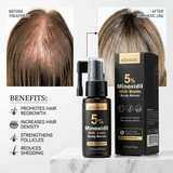 Kormesic 5% Minoxidil With Biotin Hair Regrowth Serum - 30ml