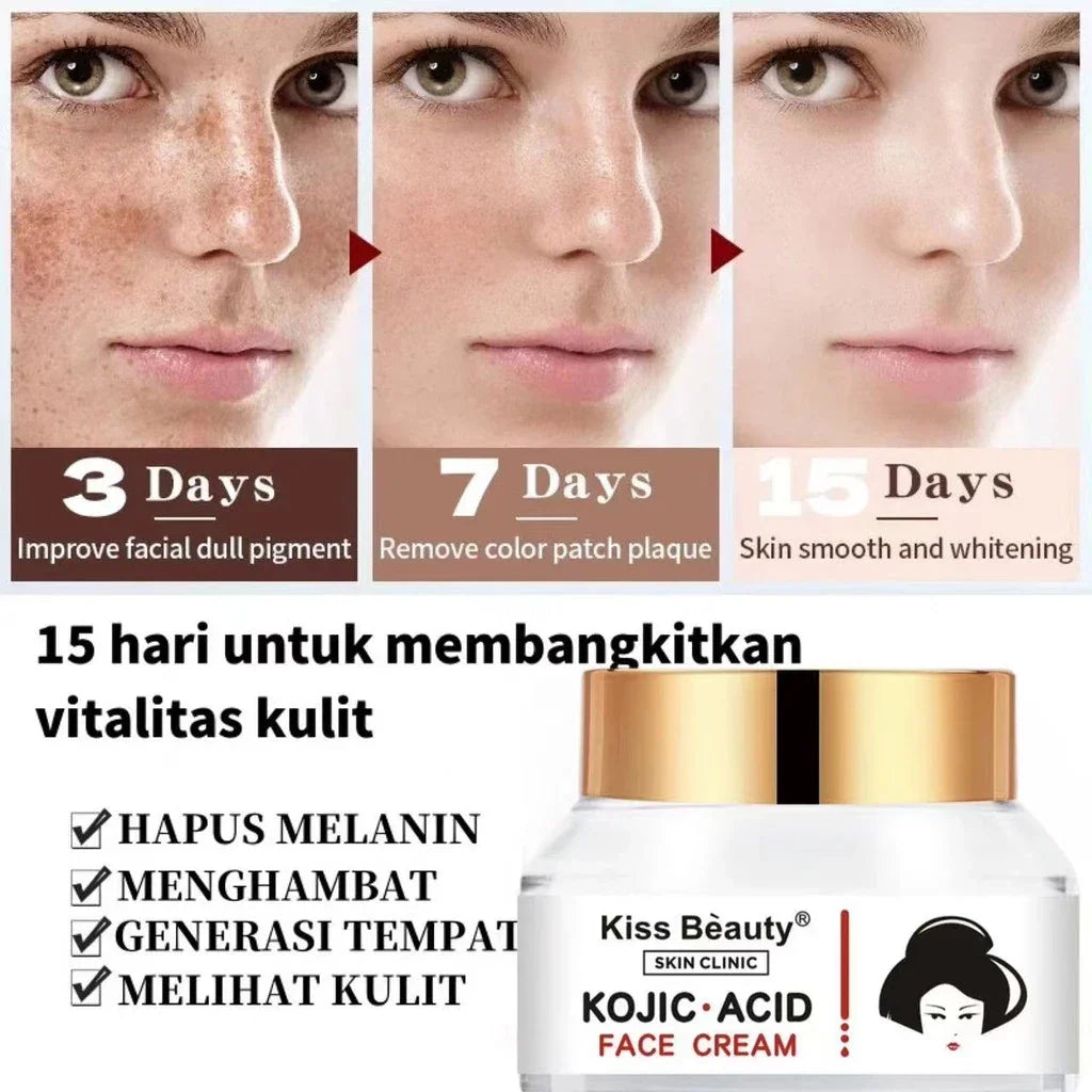 Kiss Beauty Kojic Acid Brighter Moisture Face Cream - 50g
