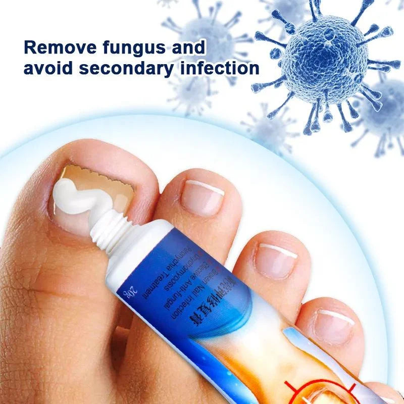 Sumifun Nail Fungus Care Cream - 20g