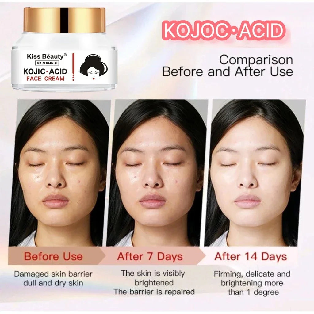 Kiss Beauty Kojic Acid Brighter Moisture Face Cream - 50g