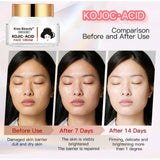Kiss Beauty Kojic Acid Brighter Moisture Face Cream - 50g