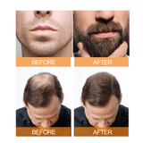 Jaysuing Hair & Beard Growth Spray - 100ml