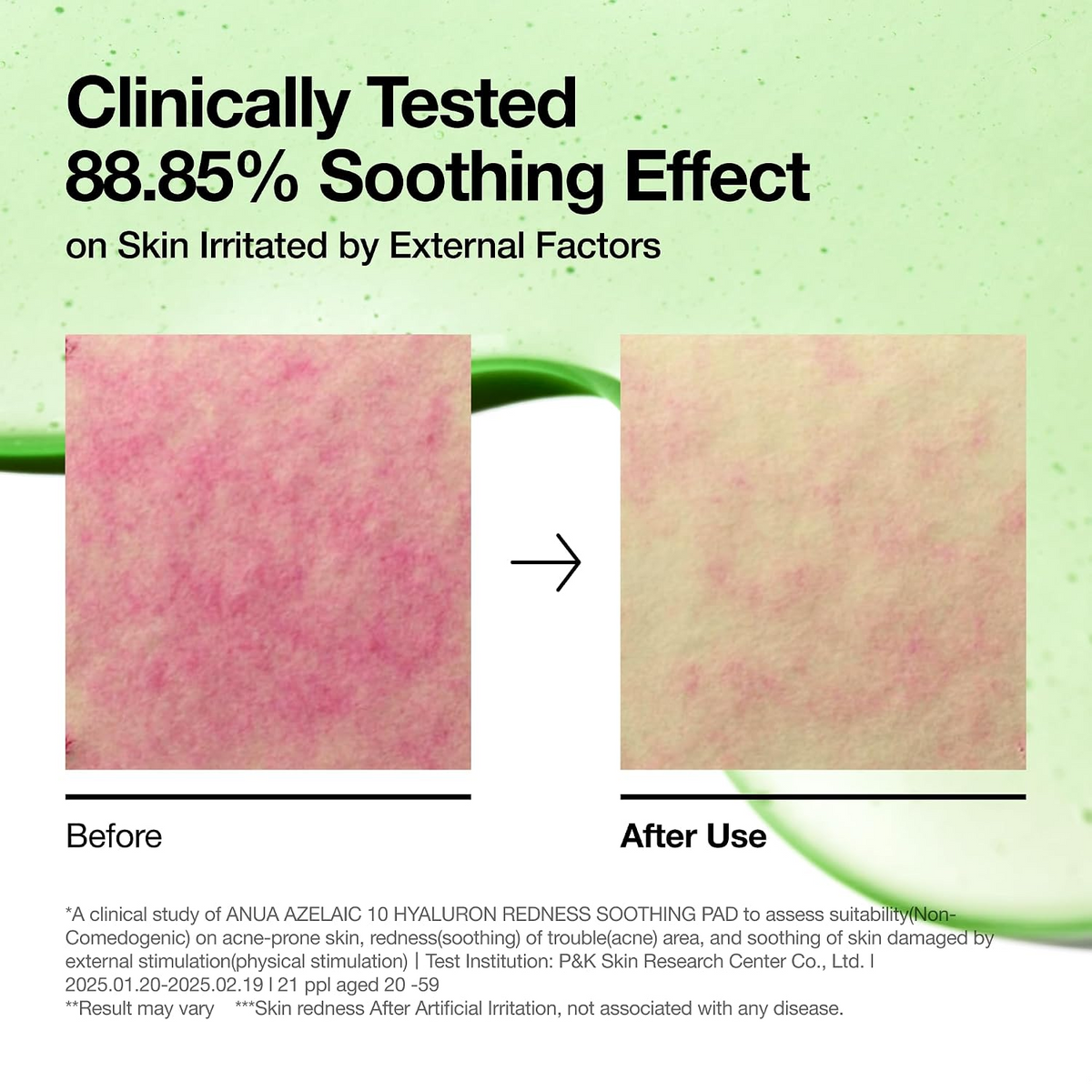 Anua Azelaic 10 Hyaluron Redness Soothing Pad - 90 Pads (230ml)