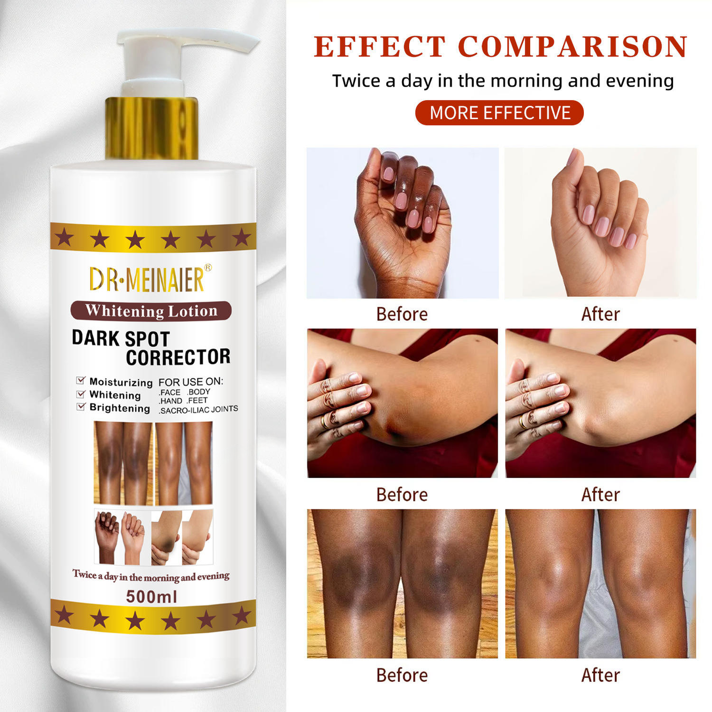 Dr.Meinaier Dark Spot Corrector Brightening Lotion - 500ml