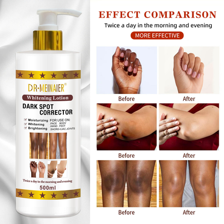 Dr.Meinaier Dark Spot Corrector Brightening Lotion - 500ml