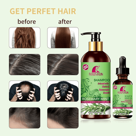 Roushun Rosemary Mint Hair Shampoo & Hair Oil - 500ml + 60ml (Combo)