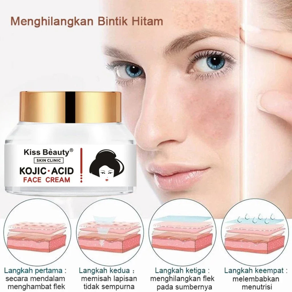 Kiss Beauty Kojic Acid Brighter Moisture Face Cream - 50g