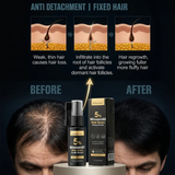 Kormesic 5% Minoxidil With Biotin Hair Regrowth Serum - 30ml