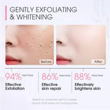 Skinever 3% Niacinamide Exfoliating Gel - 55ml