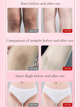 Ashley Shine Niacinamide Premium Brightening Soap - 70g