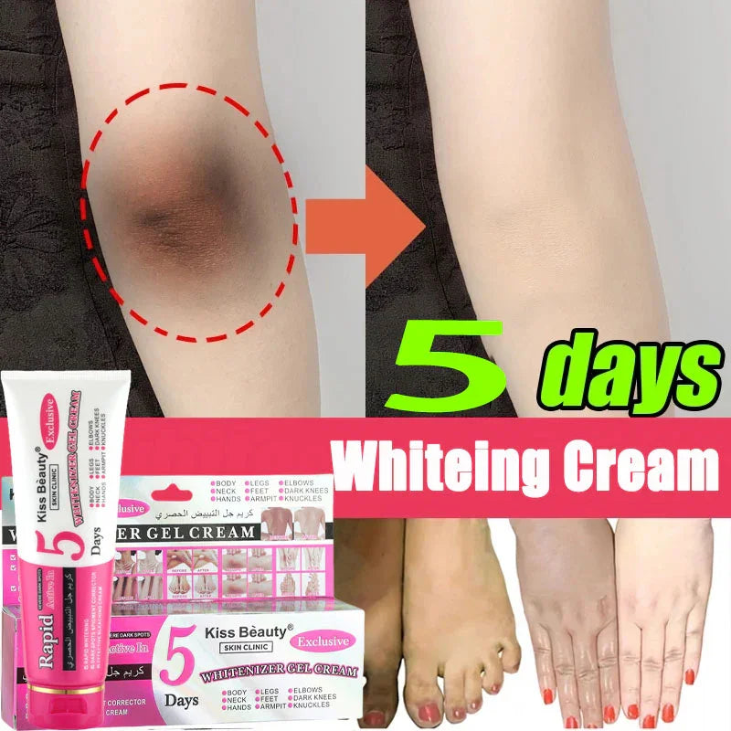 Kiss Beauty Rapid Active Body Brightening Gel Cream - 120ml