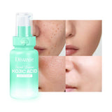 Disunie Kojic Acid & Niacinamide Facial Lotion - 160ml