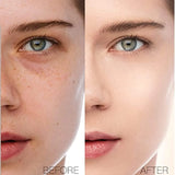 Ever Beauty BB Medical Foundation Waterproof - 60ml