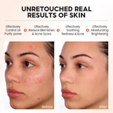 Vibrant Glamour Salicylic Acid 2% Exfoliating Serum - 30ml