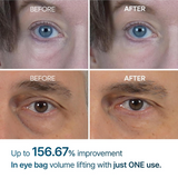 Dr.Melaxin Eyephalt Eyebag Cream - 10g