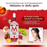 Precious Skin Miracle Anti-Melasma Facial Serum - 50ml
