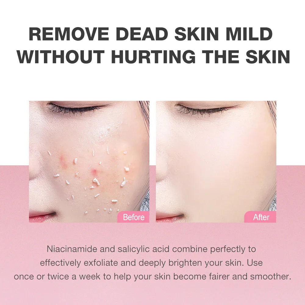 Skinever 3% Niacinamide Exfoliating Gel - 55ml