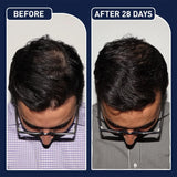 FEG Plus Hair Growth Spray Prevent Hair Loss - 50ml